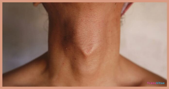 transgender tracheal shave